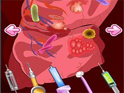 Chirurgie pulmonaire de Mori