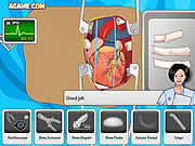 Cirurgia de coração